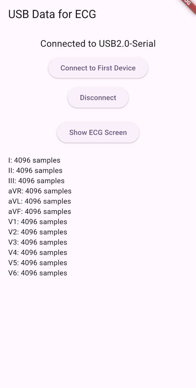 The Flutter application showing the device connection screen and the live ECG visualization with twelve lead lanes