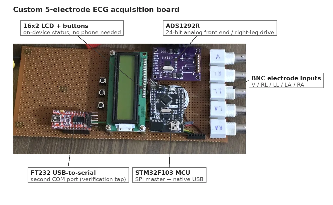 The ECG acquisition board with annotated callouts for the STM32, ADS1292R, FT232, LCD, and BNC inputs